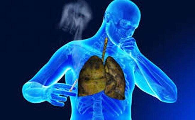 copd smoking human image